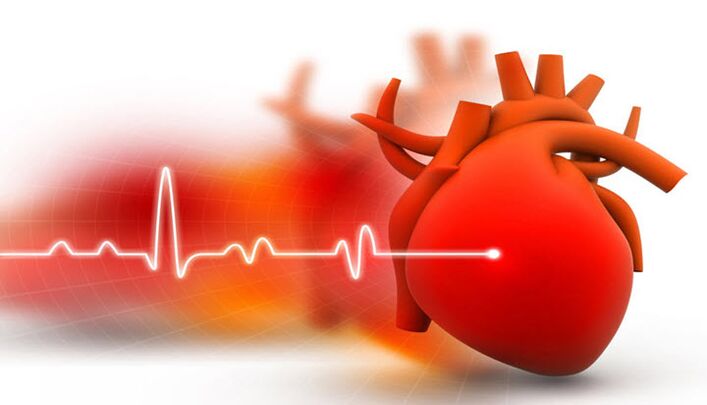 arterial hypertension